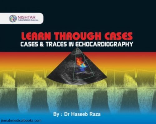 Learn Through Cases & Traces in Echocardiography Dr Haseeb Raza
