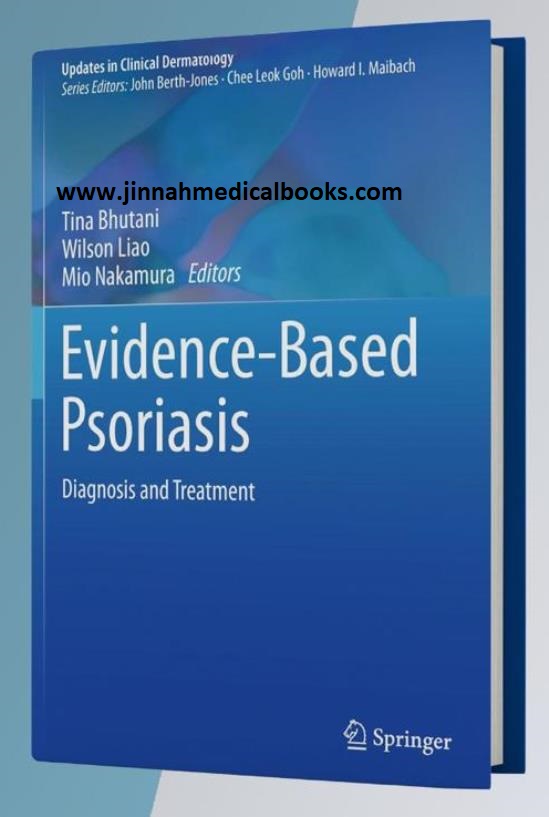 Evidence Based Psoriasis Diagnosis and Treatment