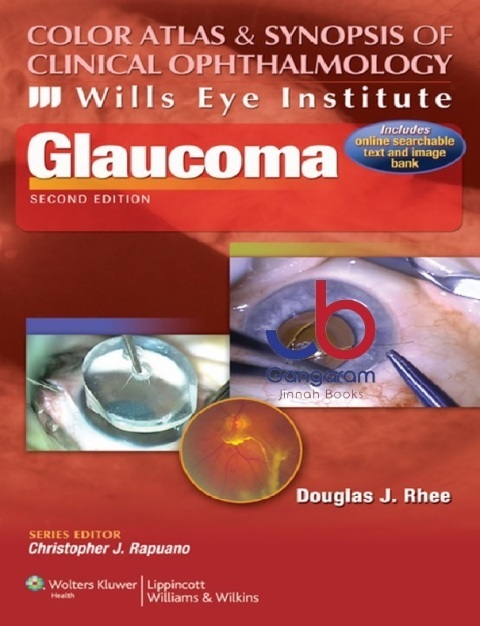Glaucoma (Color Atlas & Synopsis of Clinical Ophthalmology - Wills Eye Institute) 2nd Edition