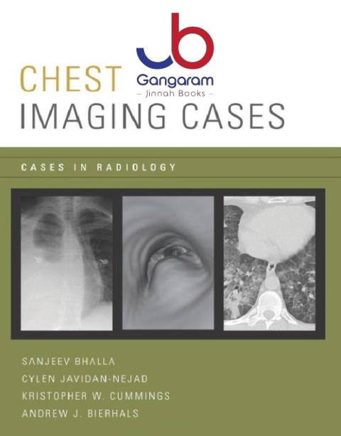 Chest Imaging Cases (Cases in Radiology) Illustrated Edition