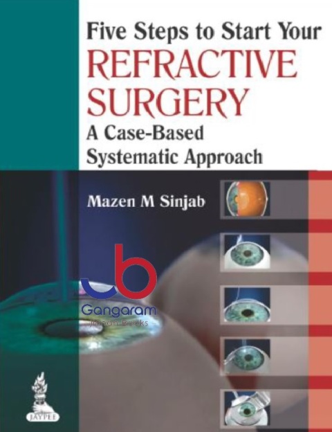 Five Steps To Start Your Refractive Surgery A Case-Based Systematic Approach 1st Edition
