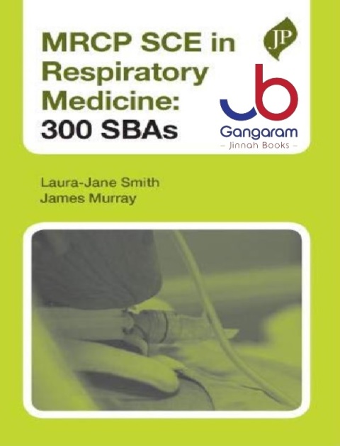 MRCP SCE in Respiratory Medicine 300 SBAs