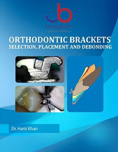 Orthodontic Brackets Selection,Placement and Debonding