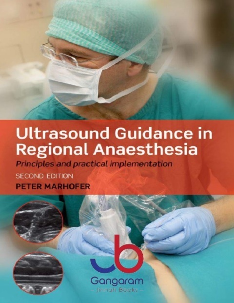 Ultrasound Guidance in Regional Anaesthesia Principles and practical implementation 2nd Edition
