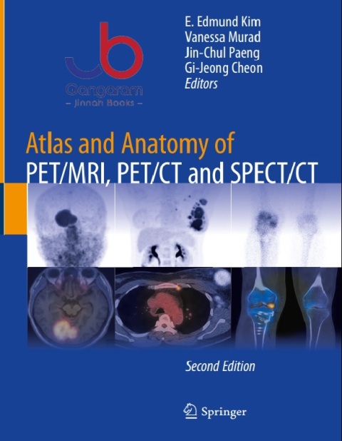Atlas and Anatomy of PETMRI, PETCT and SPECTCT 2nd edition