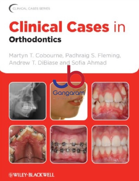 Clinical Cases in Orthodontics 1st Edition