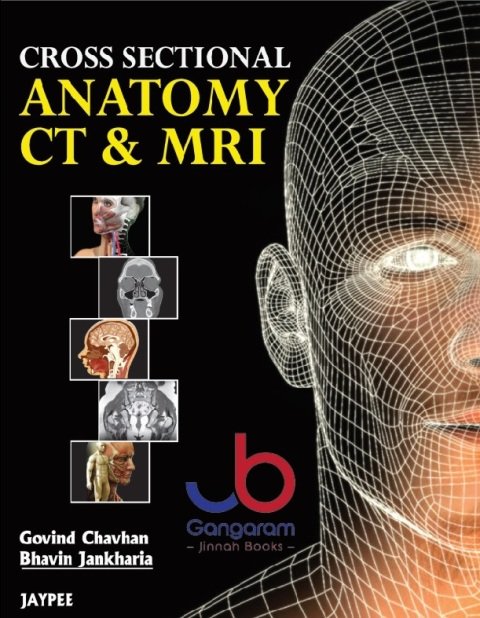 Cross Sectional Anatomy CT and MRI 1st Edition