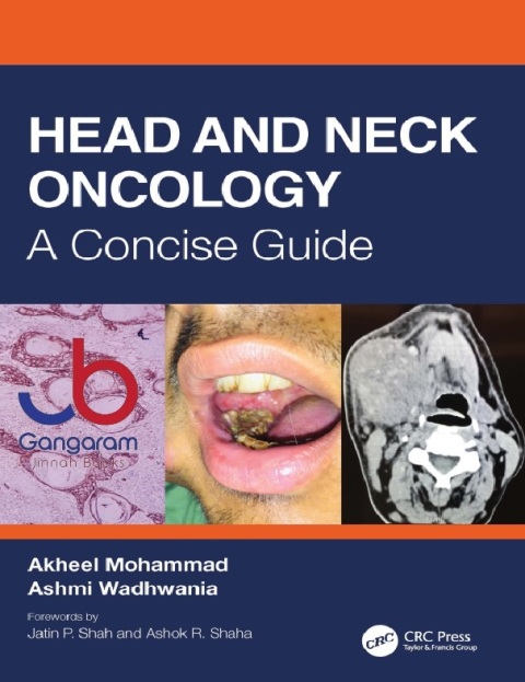 Head and Neck Oncology A Concise Guide 1st Edition