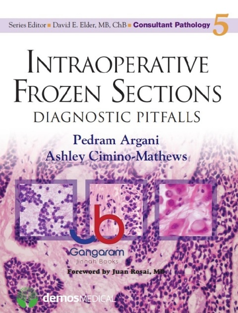 Intraoperative Frozen Sections Diagnostic Pitfalls (Consultant Pathology, Volume 5) 1st Edition