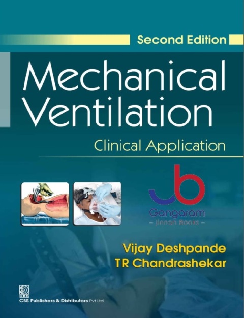 Mechanical Ventilation Clinical Application 2Ed