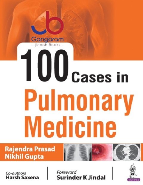 100 Cases in Pulmonary Medicine 1st Edition