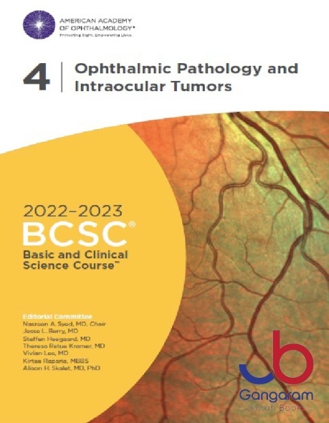Basic and Clinical Science Course Ophthalmology BCSC Ophthalmic Pathology and Intraocular Tumors.