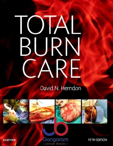 Total Burn Care Expert Consult 5th Edition