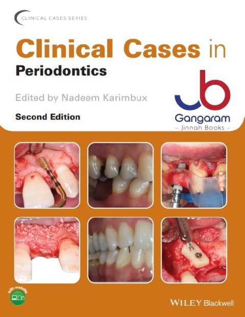 Clinical Cases in Periodontics (Clinical Cases (Dentistry)) 2nd Edition