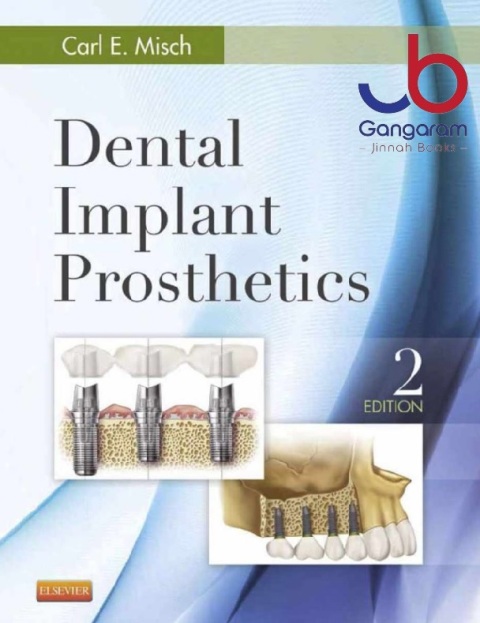 Dental Implant Prosthetics 2nd Edition