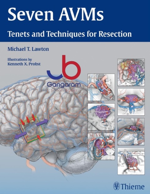 Seven AVMs Tenets and Techniques for Resection Illustrated Edition
