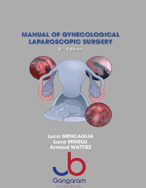 manual of gynecological laparoscopic surgery 2nd edition