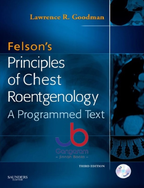 Felson's Principles of Chest Roentgenology Text 3rd Edition