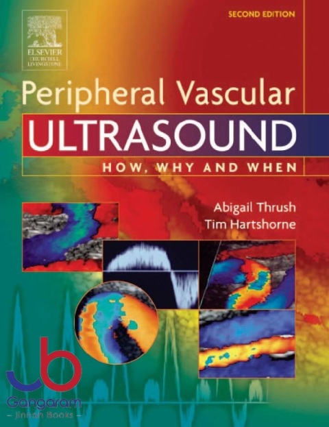 Peripheral Vascular Ultrasound How, Why and When 2nd Edition