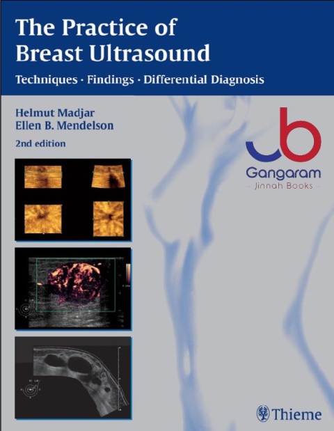 The Practice of Breast Ultrasound Techniques, Findings, Differential Diagnosis 2nd Edition