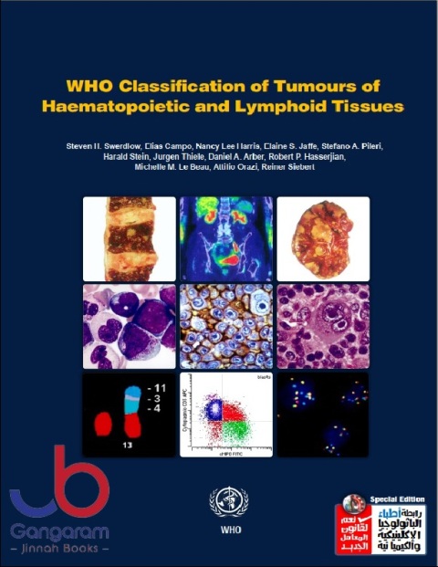 WHO Classification of Tumours of Haematopoietic and Lymphoid Tissues Revised Edition
