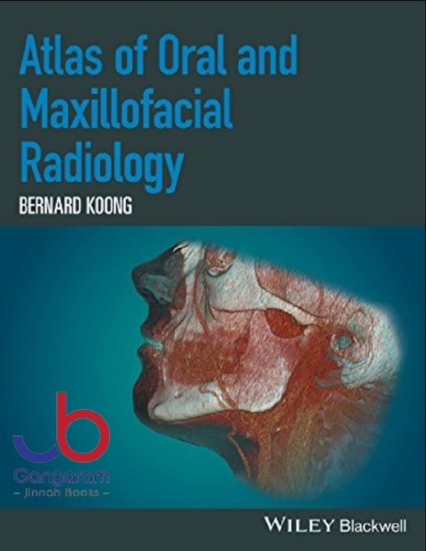 Atlas of Oral and Maxillofacial Radiology 1st Edition