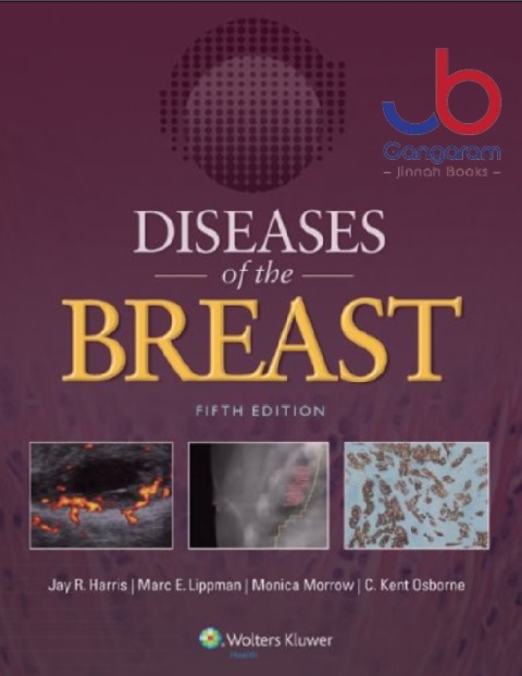 Diseases of the Breast 5e Fifth Edition
