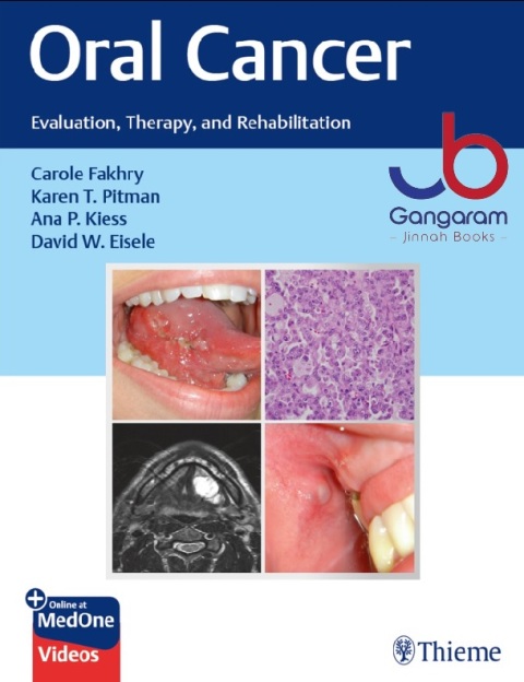 Oral Cancer Evaluation, Therapy, and Rehabilitation 1st Edition