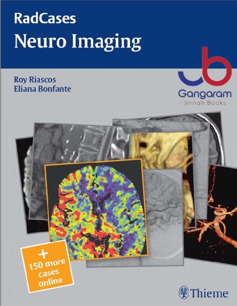 Radcases Neuro Imaging (Radcases Plus Q&A) 1st Edition