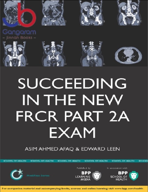 Succeeding in the New FRCR Part 2a Exam Single Best Answer (SBA) Revision Questions for Modules 1-6