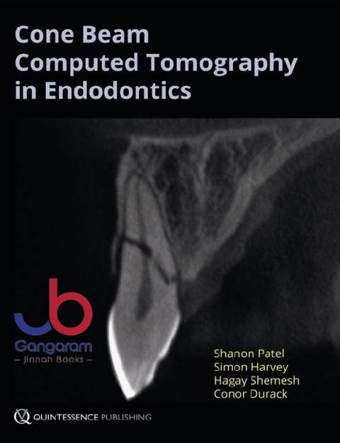 Cone Beam Computed Tomography in Endodontics 1st Edition
