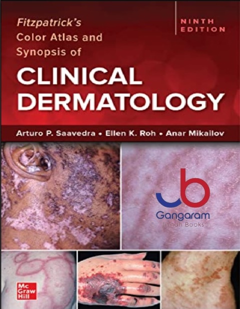 Fitzpatrick's Color Atlas and Synopsis of Clinical Dermatology, Ninth Edition 9th Edition