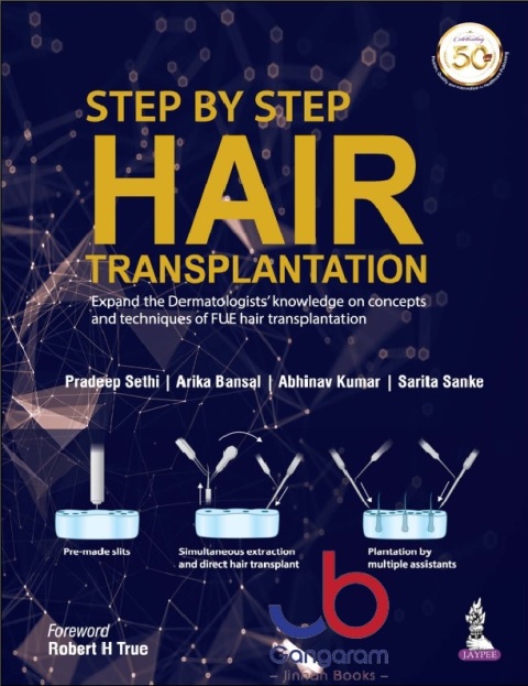Step by Step Hair Transplantation Expand the Dermatologist's Knowledge on Concepts and Techniques of Fue Hair Transplantation 1st Edition