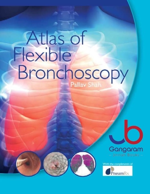 Atlas of Flexible Bronchoscopy 1st Edition