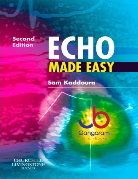 Echo Made Easy 2nd Edition