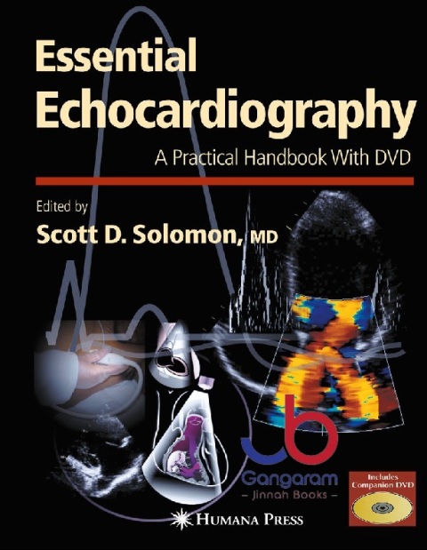 Essential Echocardiography A Practical Handbook with DVD (Contemporary Cardiology) 2007th Edition