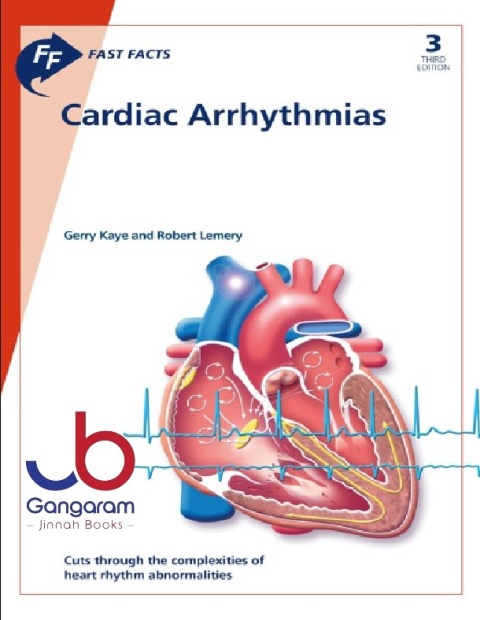 Fast Facts Cardiac Arrhythmias 3rd edition
