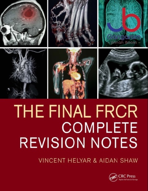 The Final FRCR Complete Revision Notes 1st Edition