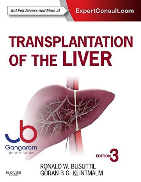 Transplantation of the Liver 3rd Edition