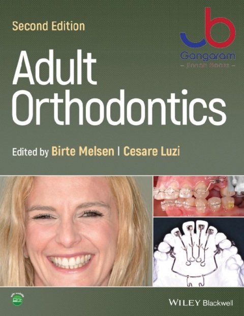 Adult Orthodontics