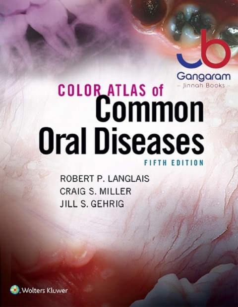 Color Atlas of Common Oral Diseases 5th Edition