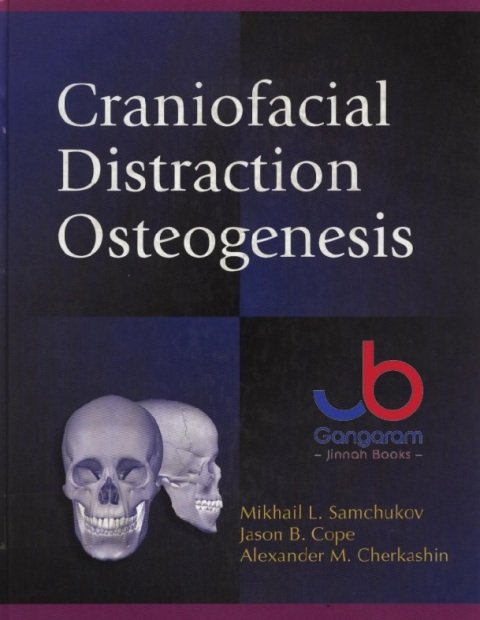 Craniofacial Distraction Osteogenesis 1st Edition