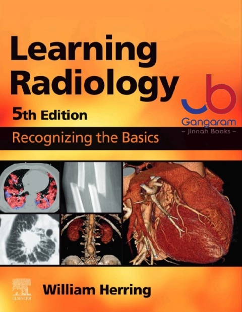 Learning Radiology Recognizing the Basics 5th Edition