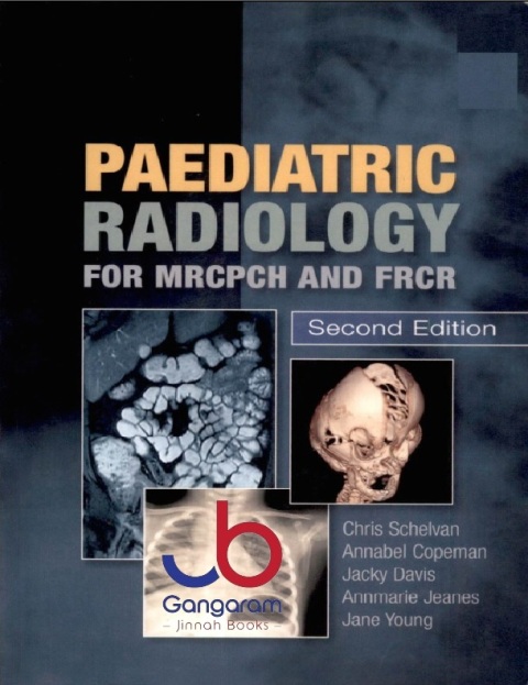 Paediatric Radiology for MRCPCH and FRCR, 2nd Edition