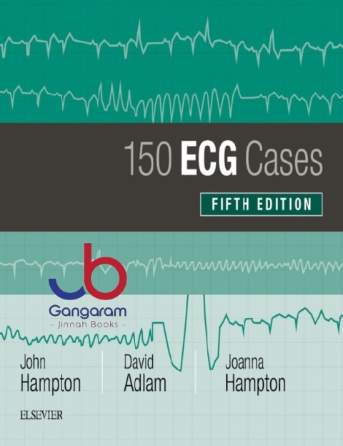 150 ECG Cases 5th Edition