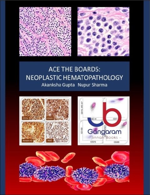 Ace the Boards Neoplastic Hematopathology (Ace My Path).