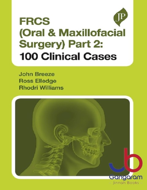 FRCS (Oral & Maxillofacial Surgery) Part 2 100 Clinical Cases 1st Edition