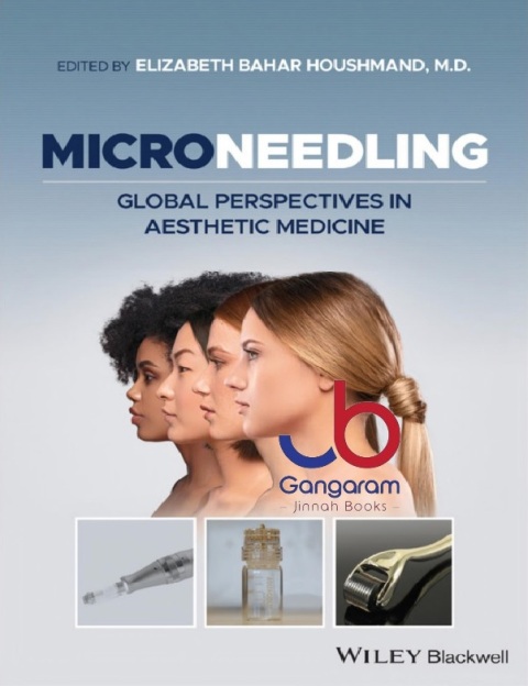 Microneedling Global Perspectives in Aesthetic Medicine 1st Edition