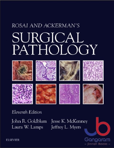 Rosai and Ackerman's Surgical Pathology - 2 Volume Set 11th Edition