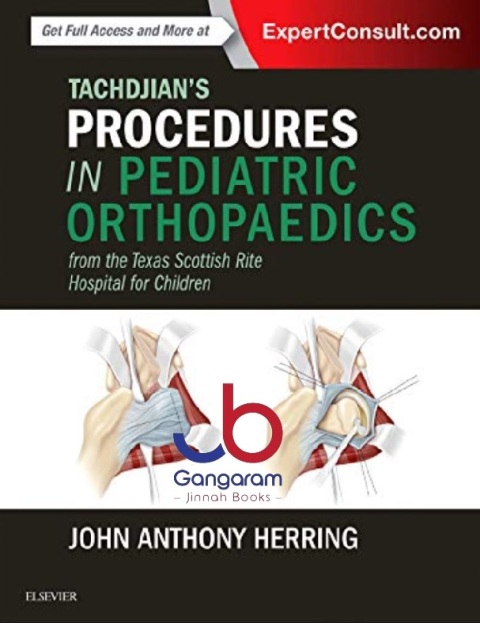 Tachdjian's Procedures in Pediatric Orthopaedics From the Texas Scottish Rite Hospital for Children 1st Edition